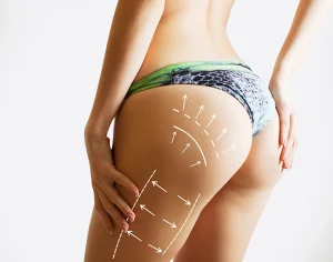 Which Type Of VASER Should I Choose?