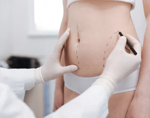 Prepare Yourself for a Lipo Treatment