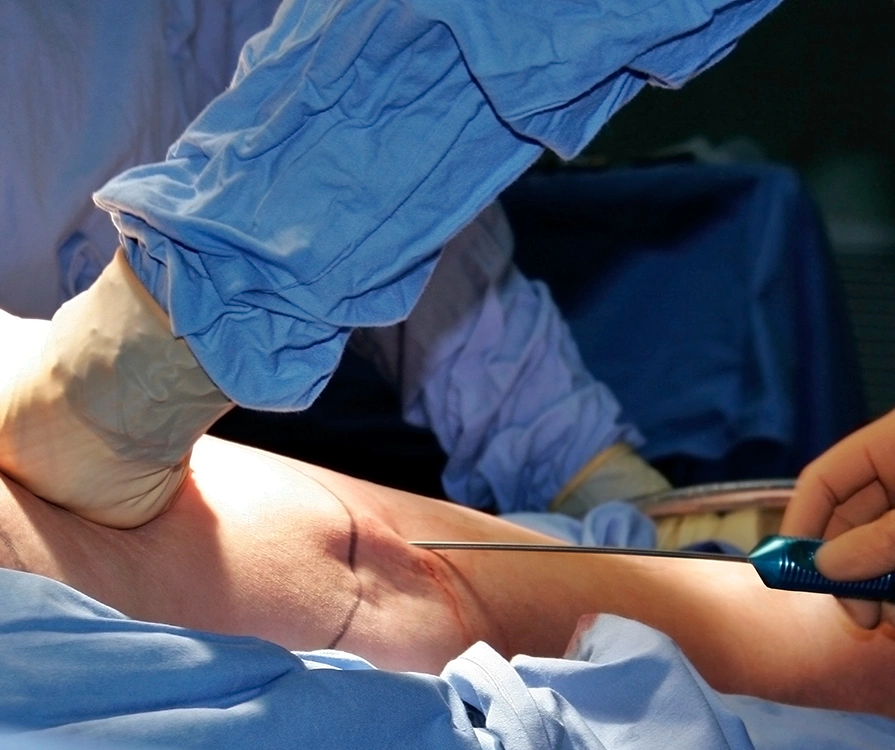 Close-up of surgeons performing Vaser liposuction procedure on patient in operating theatre