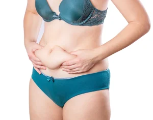 How to Tighten Skin After Vaser Liposuction