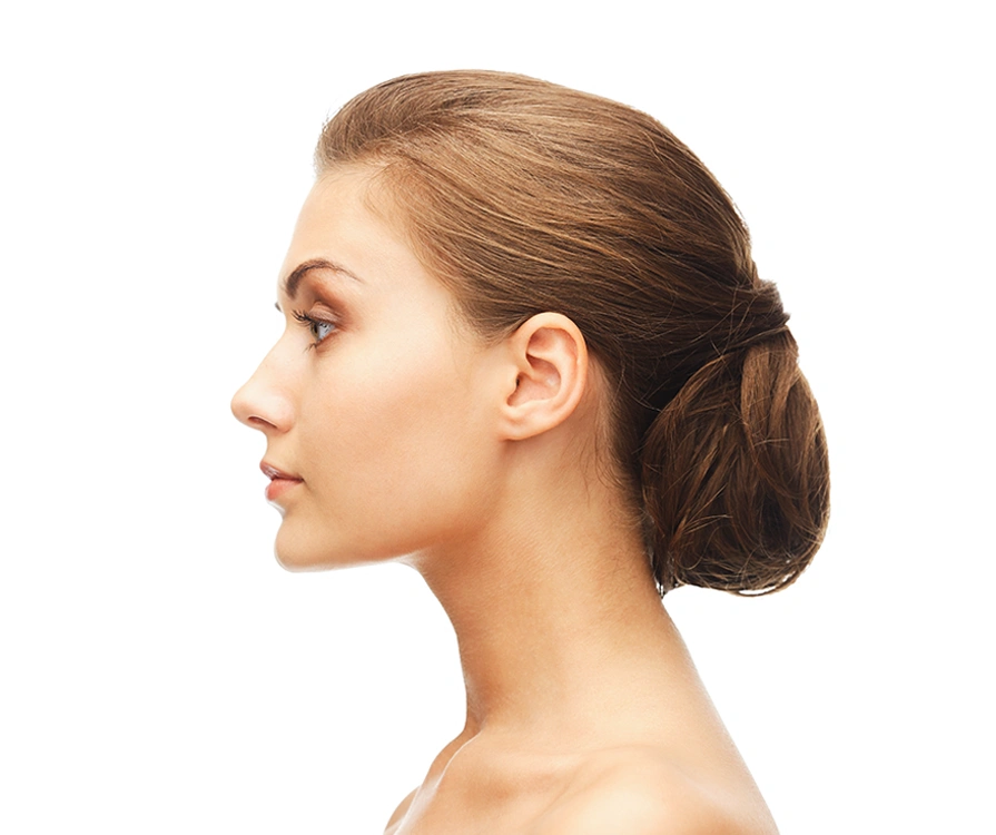 Side profile of young woman showing chin and jawline after liposuction treatment